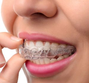 gallery img1 300x280 - 1