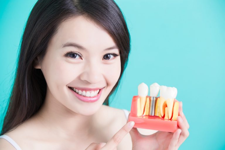 service img2 - What You Need To Know About Dental Implants
